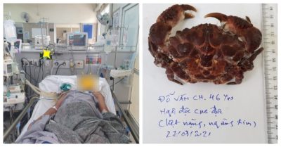 Một ngư dân ngừng tim sau khi ăn cua mặt quỷ