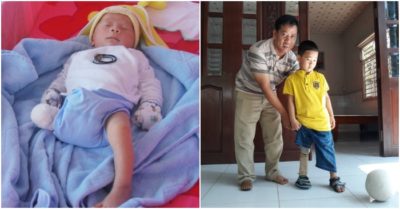 Gặp lại bé trai bị ‘văng’ khỏi bụng mẹ 7 năm trước: Chỉ còn 1 chân vẫn nhanh nhẹn