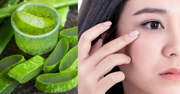Quầng thâm mắt khiến khuôn mặt bạn xuống sắc và mệt mỏi; gel lô hội dùng hàng ngày được không;