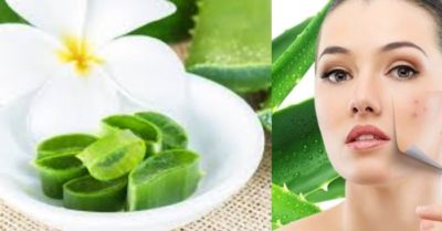 Cách sử dụng gel nha đam trong làm đẹp hiệu quả nhất